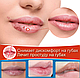 Восстанавливающий бальзам для губ Sumifun Cheilitis 20 гр. / Крем антибактериальный для лечения простуды, фото 2