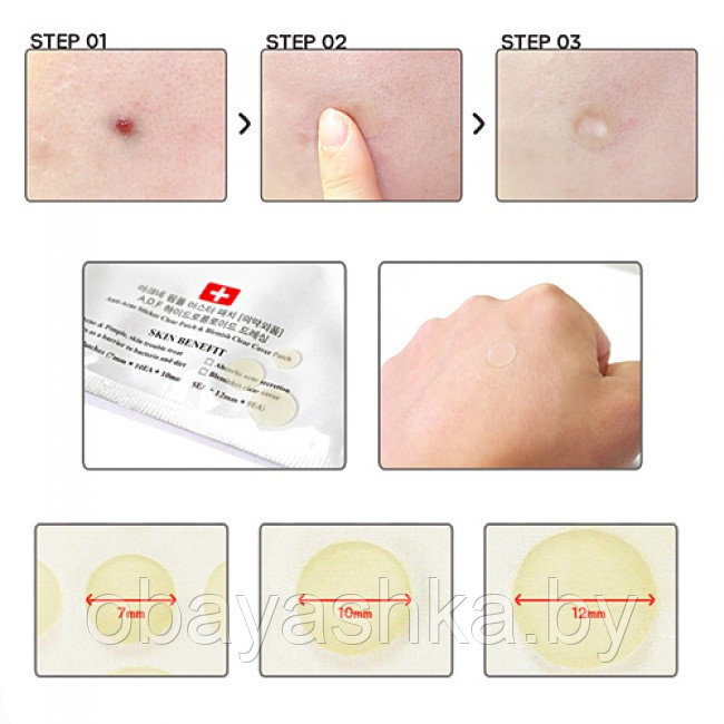 Патчи от акне противовоспалительные COSRX Acne Pimple Master Patch , 24 шт - фото 2 - id-p215846731