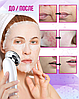 Бьюти устройство для ухода за кожей лица Beauty Instrument DS-8811 (чистка, стимуляция, подтяжка, массаж кожи, фото 9