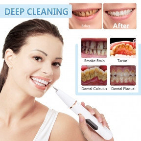 Ультразвуковой портативный скалер Electric Teeth Cleaner with LED Screen для отбеливания зубов и удаления