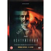 Контуженный (8 серий) (DVD)