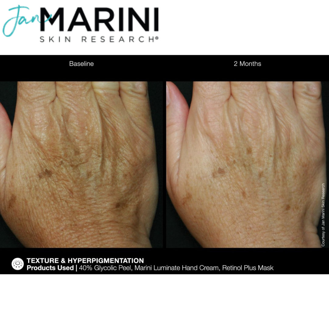 Крем для рук от пигментации Jan Marini ReNu Corrective Hand Complex - фото 7 - id-p219285947