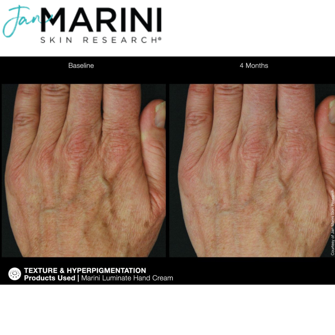 Крем для рук от пигментации Jan Marini ReNu Corrective Hand Complex - фото 9 - id-p219285947