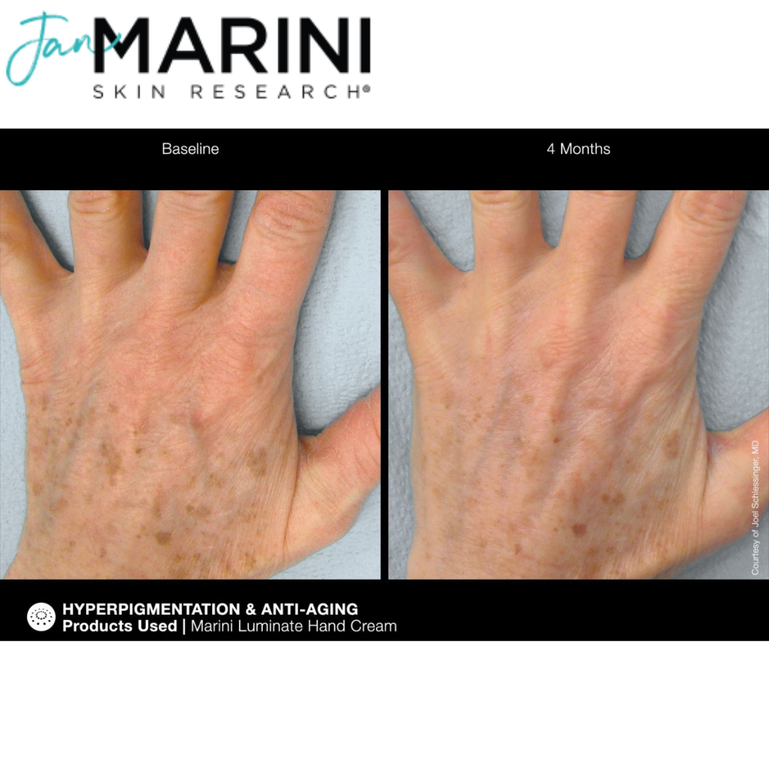 Крем для рук от пигментации Jan Marini ReNu Corrective Hand Complex - фото 6 - id-p219285947