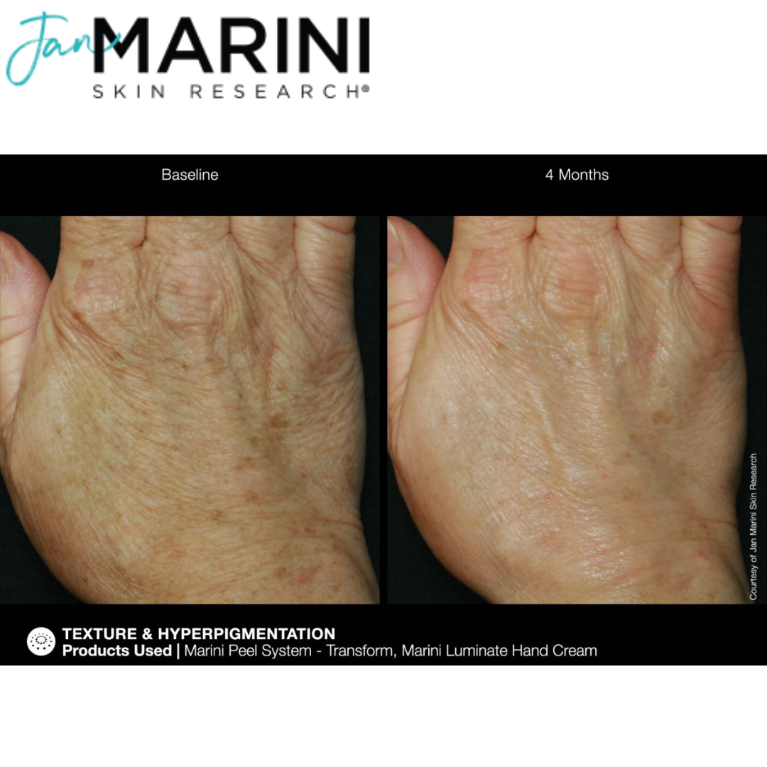 Крем для рук от пигментации Jan Marini ReNu Corrective Hand Complex - фото 10 - id-p219285947