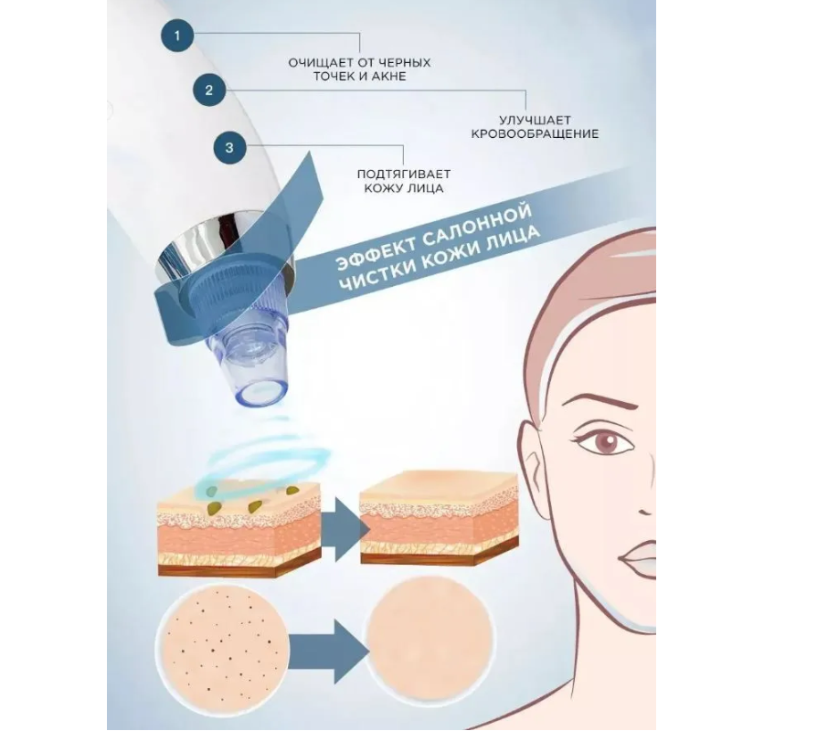 Вакуумный очиститель кожи Beauty Skin Care Specialist / Прибор для чистки лица / 4 насадки - фото 7 - id-p220800211