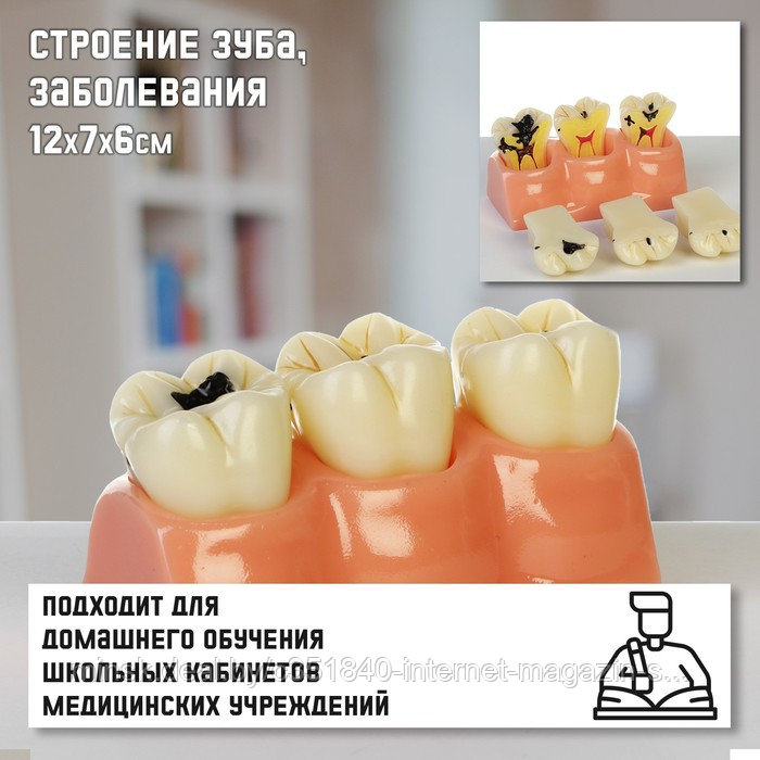 Макет "Строение зуба, заболевания", 12*7*6см (ID#221669906), цена: 74. ...