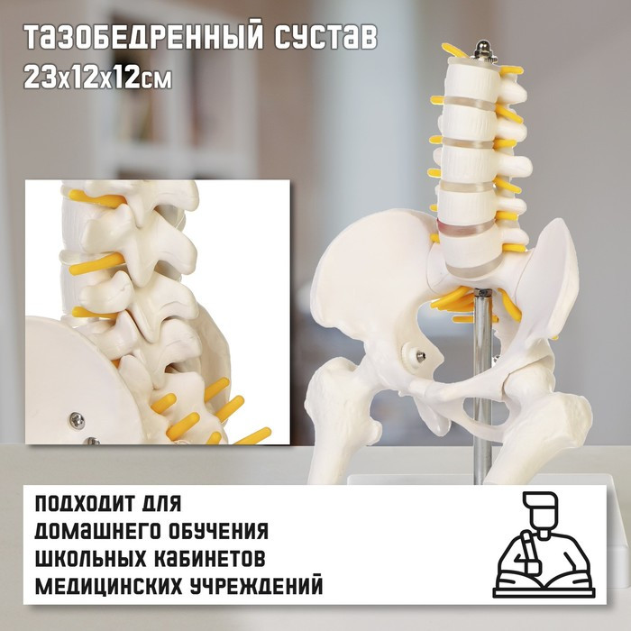 Макет "Поясничный отдел позвоночника, тазобедренный сустав" 23*12*12см - фото 1 - id-p221669247