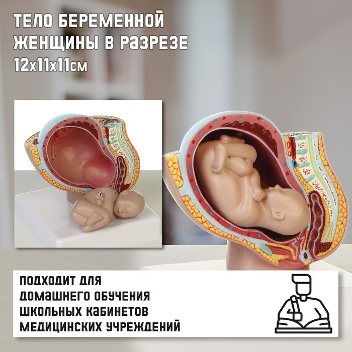 Макет "Тело беременной женщины в разрезе" 12*11*11см - фото 1 - id-p221676770