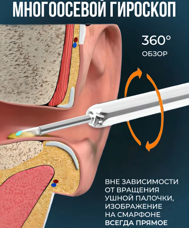 Умная ушная палочка с камерой (отоскоп) для чистки ушей Wireless Visual Earpick NE3 Белый - фото 2 - id-p222015462