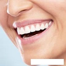 Электрическая зубная щетка Oral-B Pro 1 750 Cross Action D16.513.1UX (черный), фото 3
