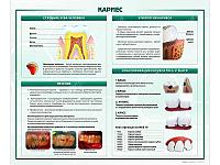 Стенд "Кариес"