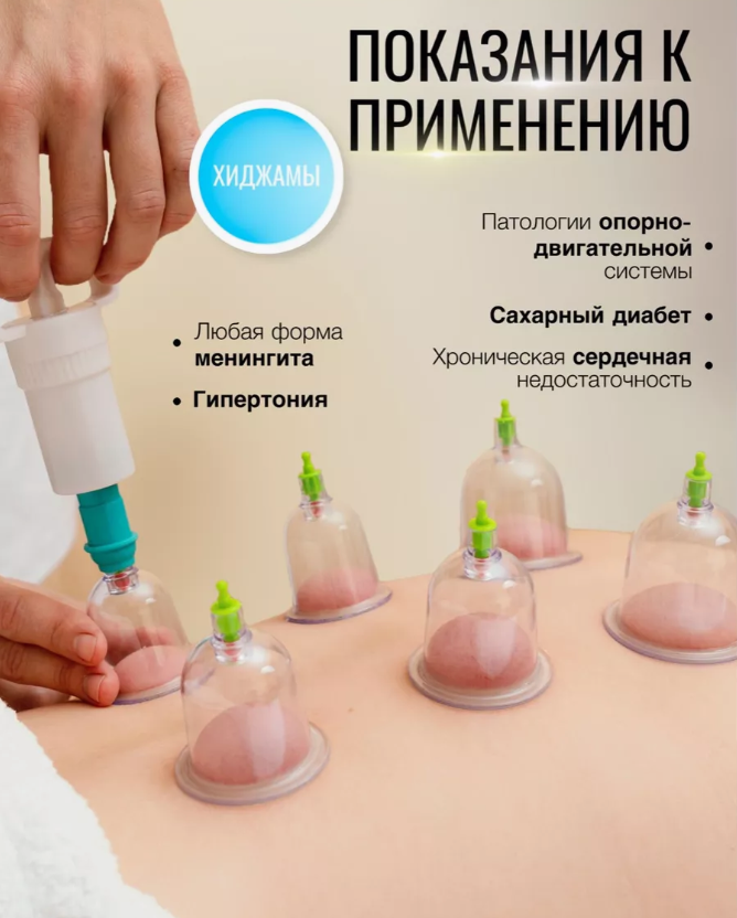 Набор Вакуумные банки для хиджамны и массажа с насосом 12 шт. AL HiJaMa - фото 9 - id-p223273755