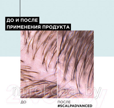 Шампунь для волос L'Oreal Professionnel Scalp A-Oily - фото 9 - id-p223443843