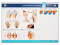 Интерактивный электрифицированный стенд "Заболевания суставов" с натурными образцами