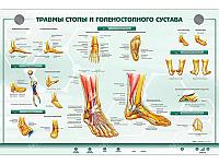 Интерактивный светодинамический стенд "Травмы стопы и голеностопного сустава"