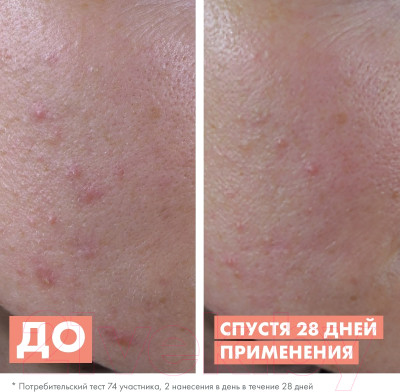 Сыворотка для лица Avene Cleanance AHA Exfoliating Serum Для жирной кожи - фото 6 - id-p224283511