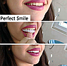 Накладные виниры для зубов Snap-On Smile / Съемные универсальные виниры для ослепительной улыбки 2 шт. (на две, фото 5
