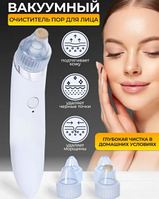 Вакуумный очиститель кожи Beauty Skin Care Specialist / Прибор для чистки лица / 4 насадки
