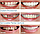 Накладные виниры для зубов Snap-On Smile / Съемные универсальные виниры для ослепительной улыбки 2 шт. (на две, фото 10