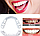 Накладные виниры для зубов Snap-On Smile / Съемные универсальные виниры для ослепительной улыбки 1 шт., фото 2