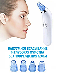 Вакуумный очиститель кожи Beauty Skin Care Specialist / Прибор для чистки лица / 4 насадки, фото 10