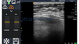Ветеринарный ультразвуковой беспроводной сканер BestScan S9, фото 4