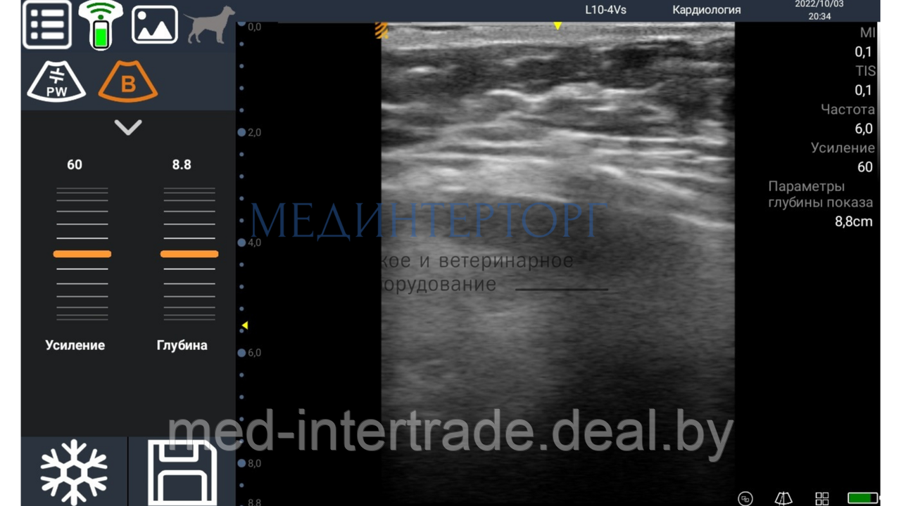 Ветеринарный ультразвуковой беспроводной сканер BestScan S9 - фото 4 - id-p199347428