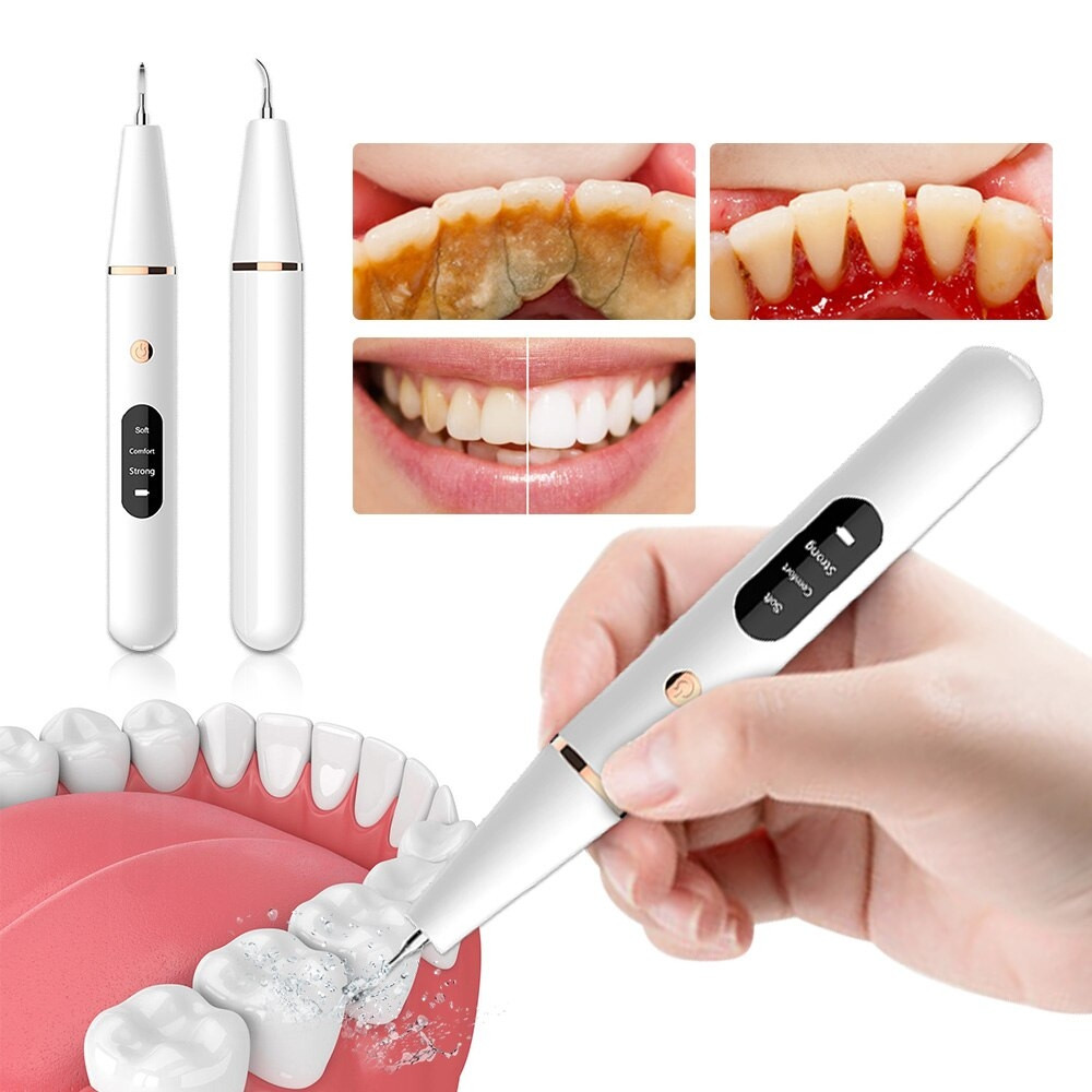 Ультразвуковой портативный скалер Household tooth cleaner для отбеливания зубов и удаления зубн - фото 1 - id-p225424148