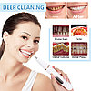 Ультразвуковой портативный скалер Household tooth cleaner  для отбеливания зубов и удаления зубн, фото 8