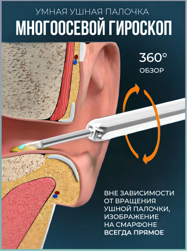 Отоскоп с камерой / Набор для чистки ушей и носа / Умная ушная палочка - фото 6 - id-p225448384