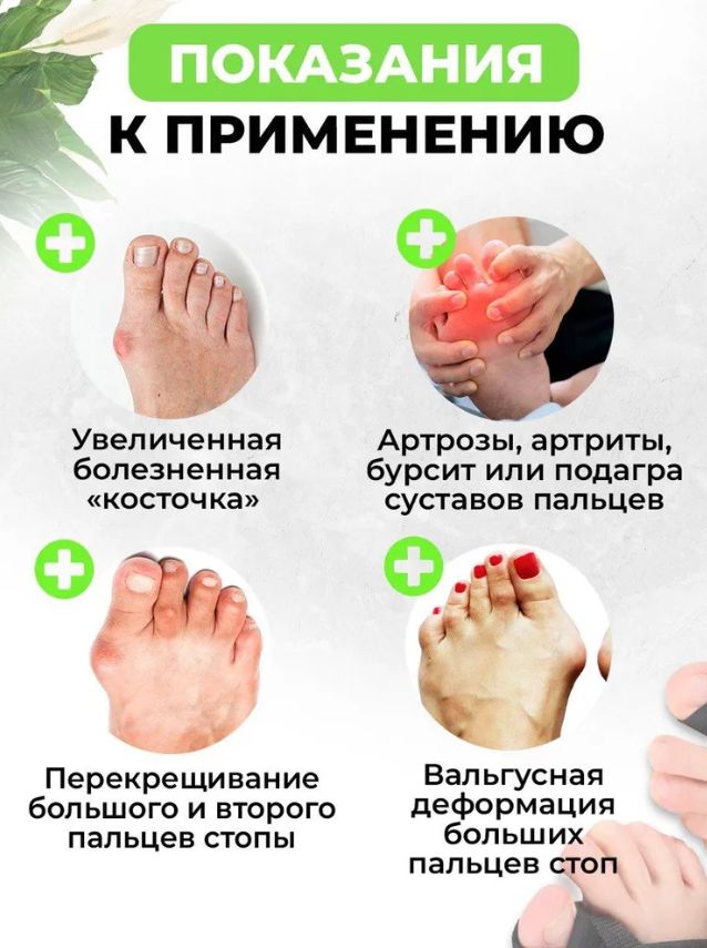 Бандаж для коррекции большого пальца 2 штуки Relax foot - фото 10 - id-p225498648