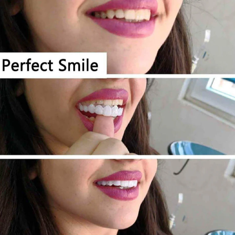 Накладные виниры для зубов Snap-On Smile 2 штуки верх и низ - фото 8 - id-p225504794