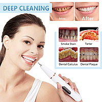 Ультразвуковой портативный скалер Electric Teeth Cleaner with LED Screen для отбеливания зубов