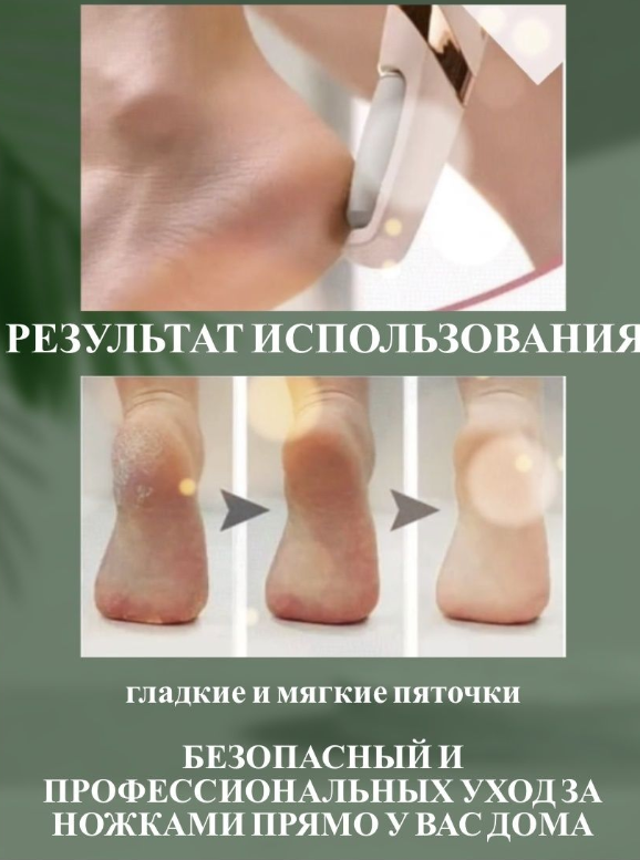 Пилка электрическая роликовая Electric Pedi / Аппарат для педикюра (две насадки) / Пемза - фото 3 - id-p225504349