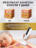 Вакуумный антицеллюлитный массажер для тела Intellegent negative pressure cupping massage instrument, фото 8