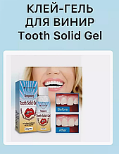 Клей-гель для виниров Tooth Solid Gel (30 мл)