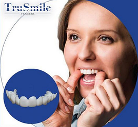 Съемные виниры TruSmile (верхние)