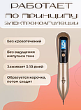 Аппарат для удаления бородавок, папиллом, веснушек, фото 3