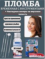 Временная пломба/накладные виниры на верхнюю челюсть