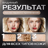 Косметический аппарат для удаления папиллом и бородавок, фото 5