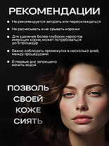 Косметический аппарат для удаления папиллом и бородавок, фото 3