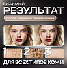 Косметический аппарат для удаления папиллом и бородавок, фото 3