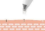 Аппарат для чистки лица inFace Blackhead Remover Розовый, фото 4