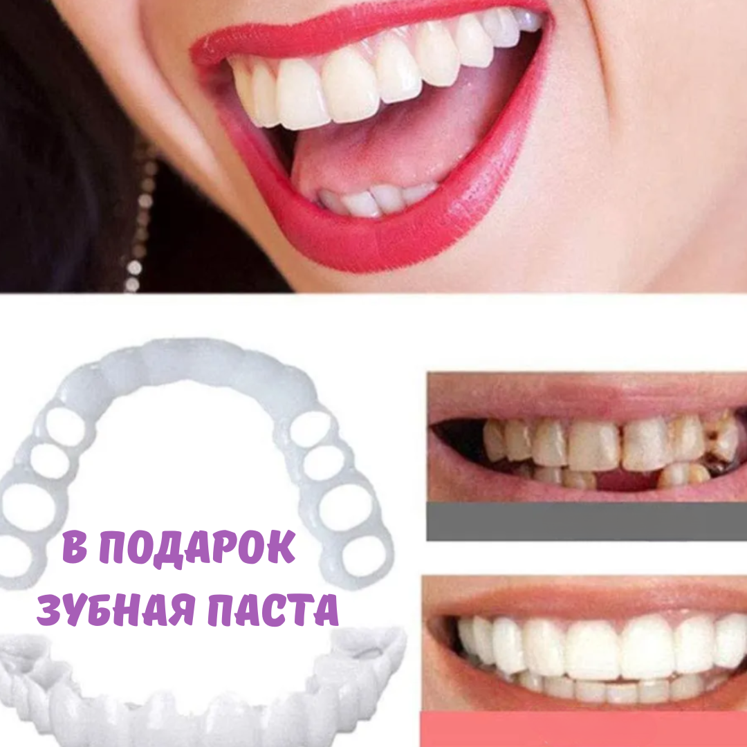 Накладные / Съемные виниры для зубов CRYSTAL VENEERS - 2 шт.(верх+низ)