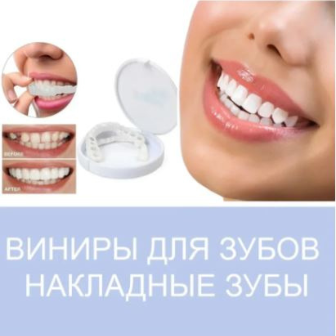 Накладные/съемные декоративные виниры для зубов Snap-On Smile 2 шт.(верх и низ)