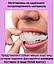 Накладные/съемные декоративные виниры для зубов Snap-On Smile 1шт. (нижние), фото 2