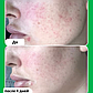 Сыворотка бустер Paula’s Choice 10% Azelaic Acid Booster 30мл, фото 4