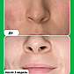 Сыворотка бустер Paula’s Choice 10% Azelaic Acid Booster 30мл, фото 6