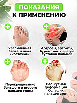 Разделитель для пальцев вальгусная шина, 2 шт, фото 3